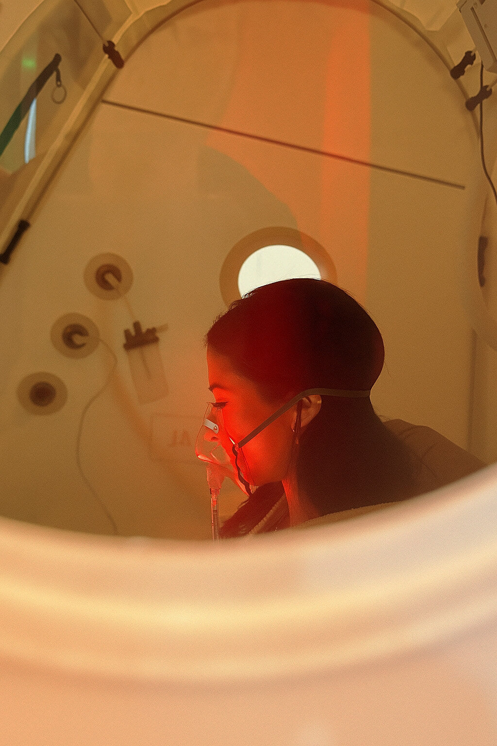 Hyperbaric Oxygen
